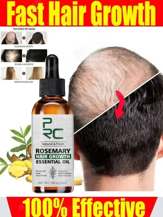 Hair Growth Products Biotin Anti Hair Loss Spray Scalp Fast Growing Essential Oils Hair Care