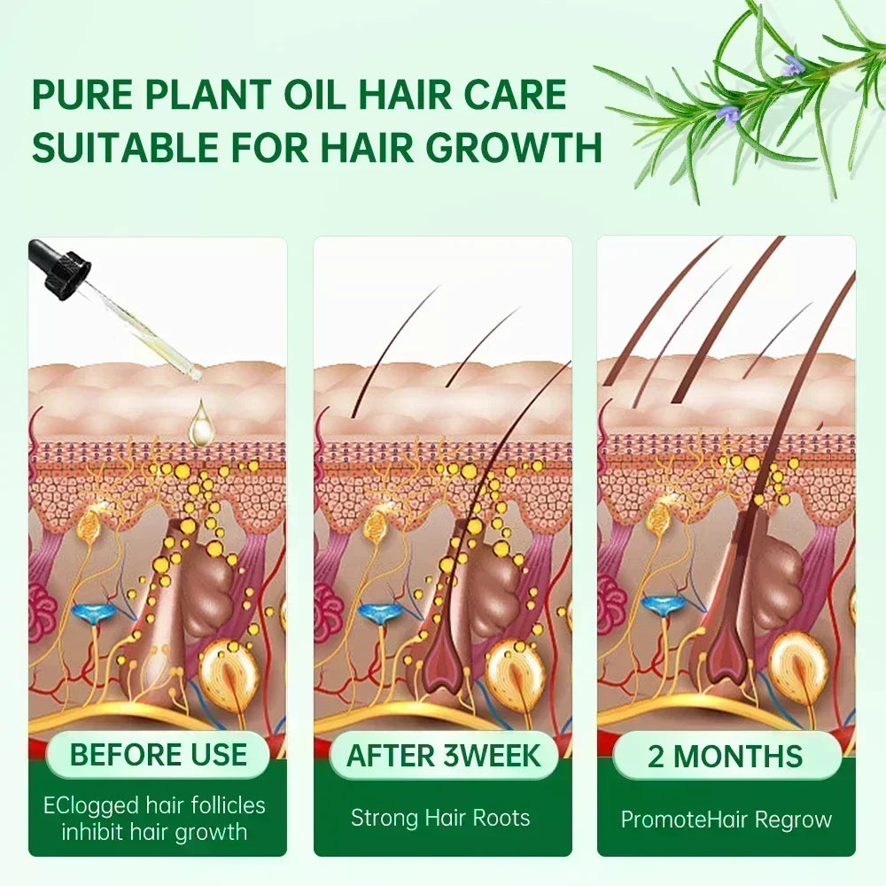 Hair Growth Products Biotin Anti Hair Loss Spray Scalp Fast Growing Essential Oils Hair Care