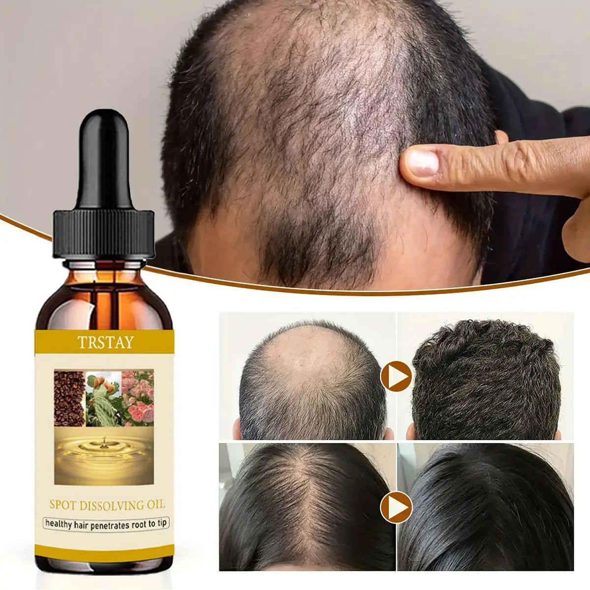 50ML Beard Growth Oil Anti Alopecia Hair Regrowth Essential Oils Essence for Man Woman