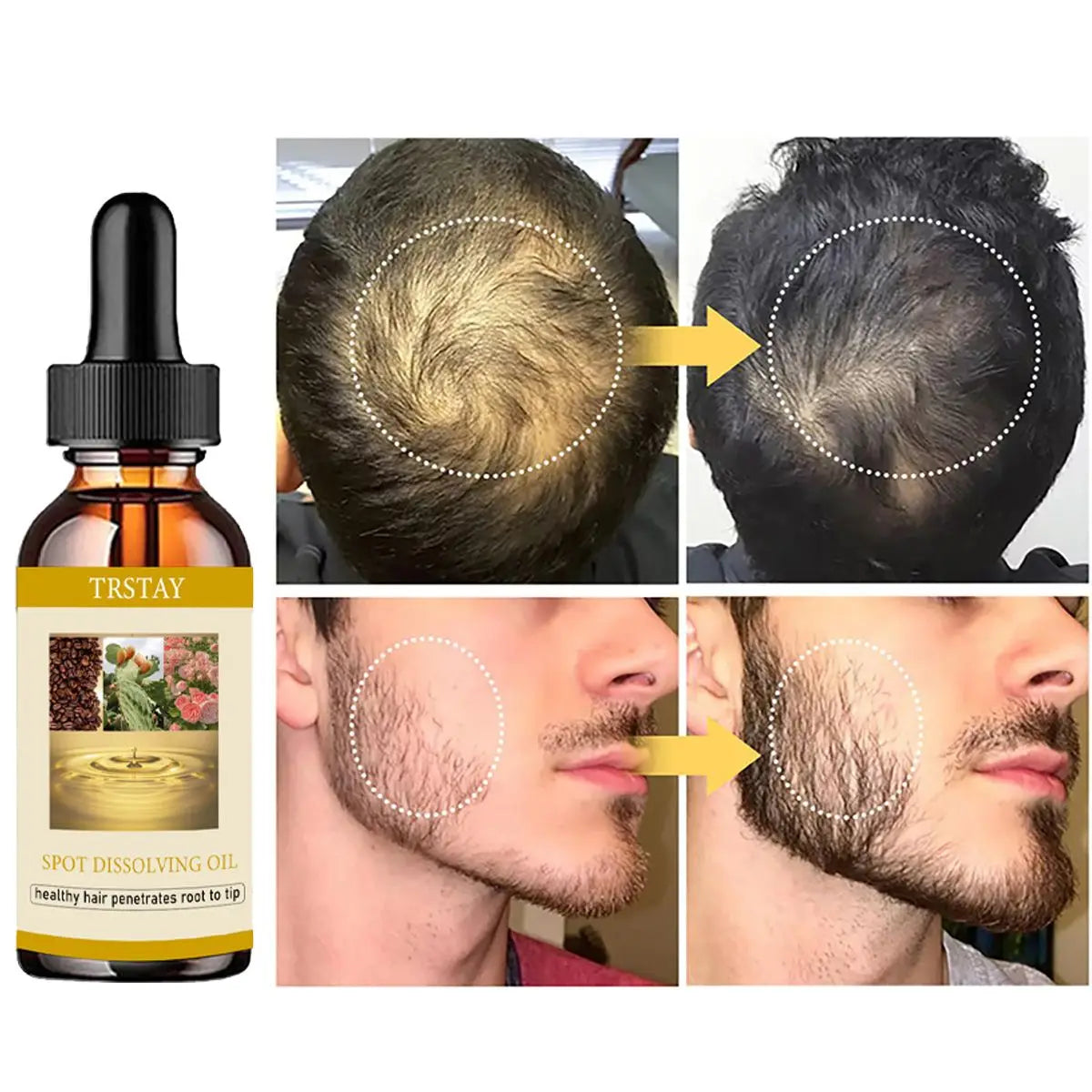 50ML Beard Growth Oil Anti Alopecia Hair Regrowth Essential Oils Essence for Man Woman